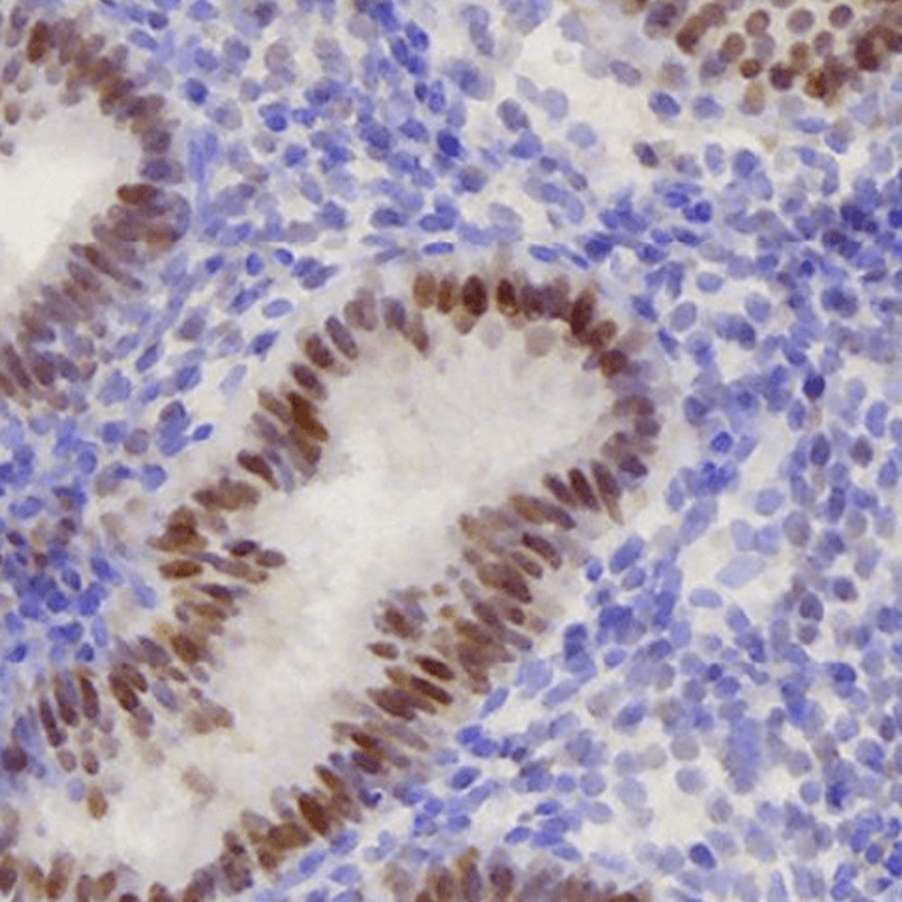 Immunhistologisch gefaerbter Gewebeschnitt der Gebaermutterschleimhaut