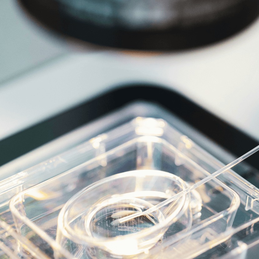 Kulturschale mit Transferpipette unter dem Mikroskop