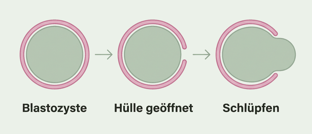 Drei Stadien nebeneinander: Blastozyste in geschlossener Hülle, geöffnete Hülle, schlüpfender Embryo