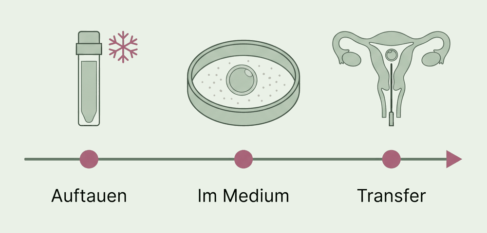 Der Auftautag in drei Schritten: Auftauen aus der Kryolagerung, einige Stunden in der Schale mit dem Medium, dann Transfer in die Gebärmutter