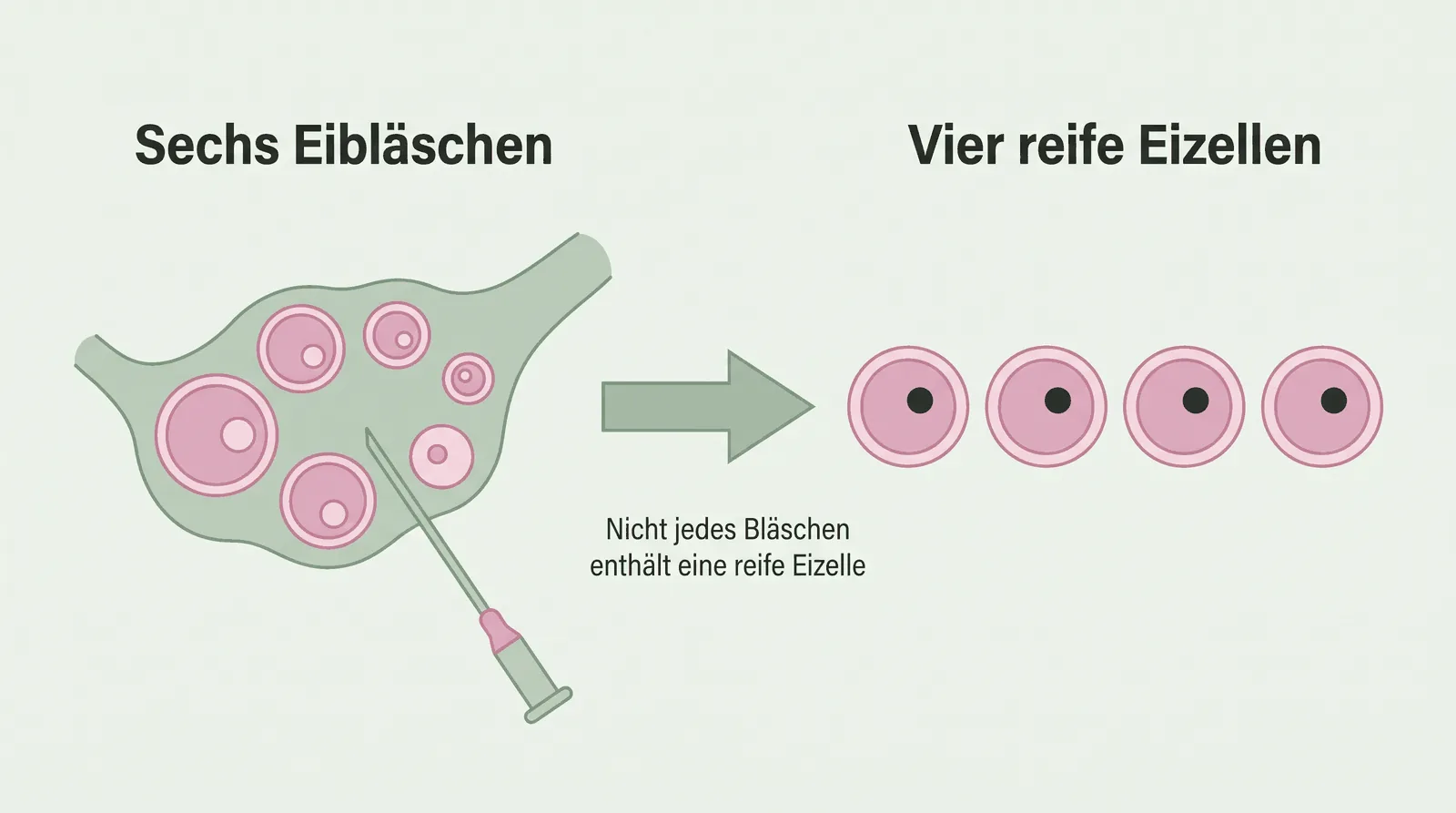 Ein Eierstock mit sechs Eibläschen, daneben vier gewonnene Eizellen